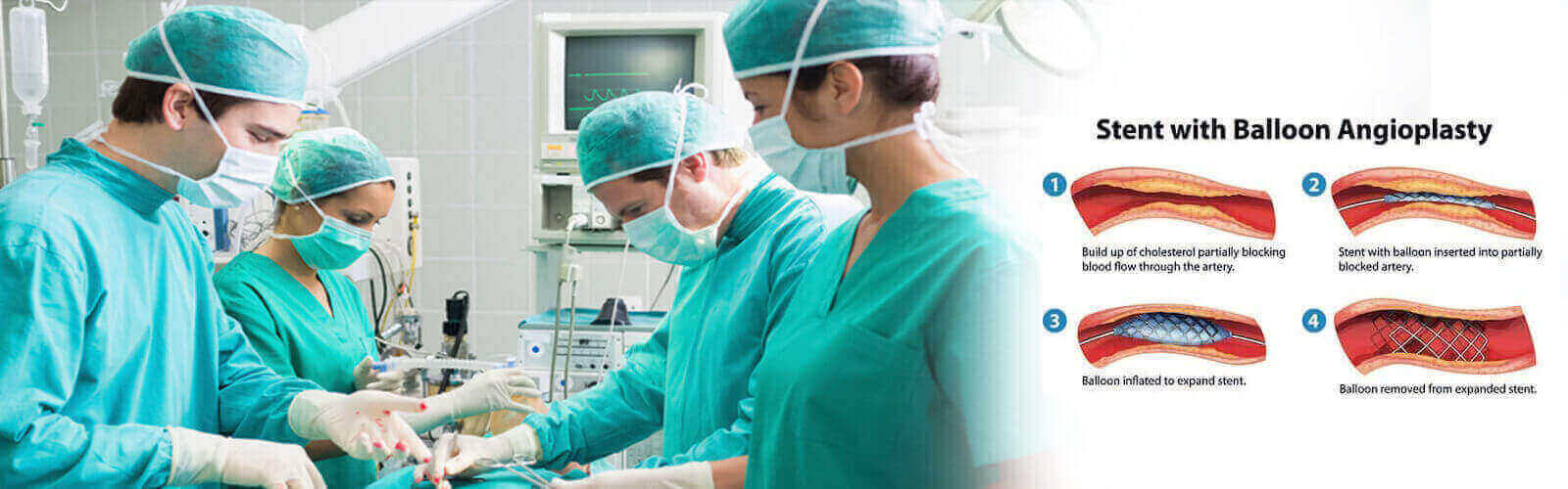Angioplasty Surgery in Kentucky