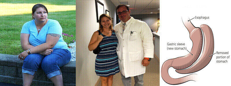 Bariatric Surgery in Thailand