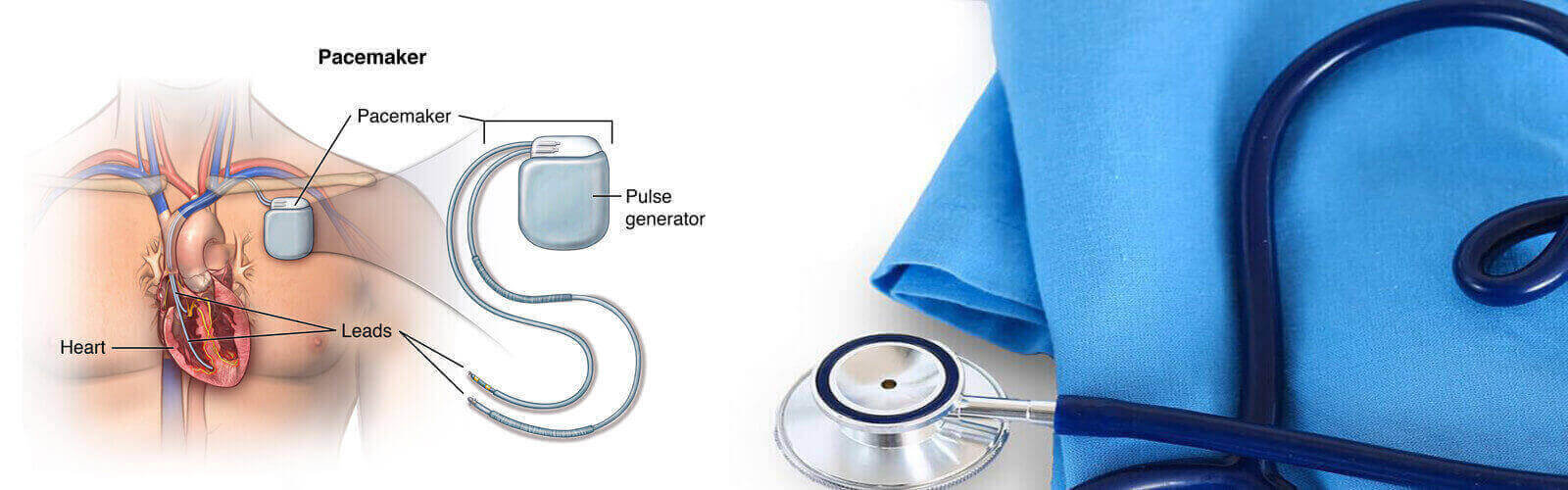 Pacemaker Surgery in Thailand