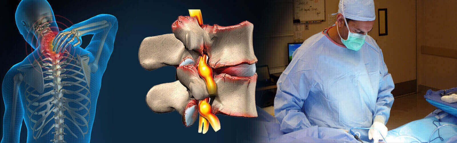 Spinal Stenosis Surgery in Thailand