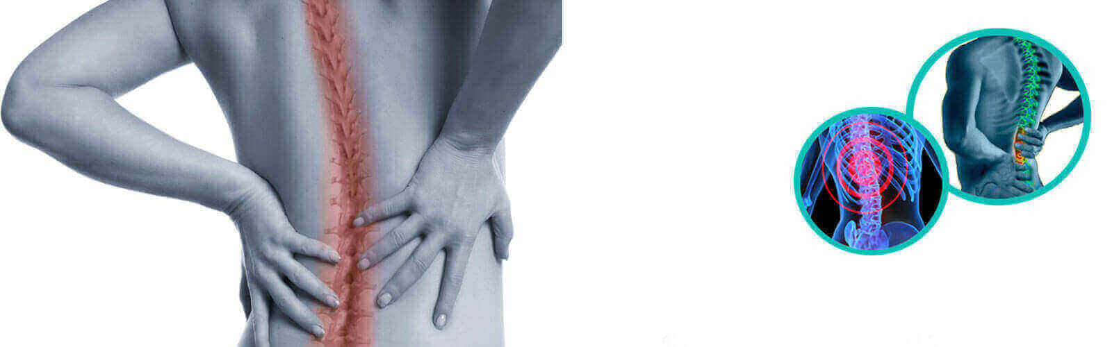 Spinal Surgery Or Spine Surgery in Thailand