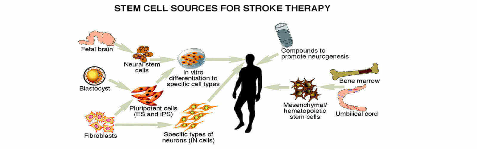 Stem Cell Therapy in Thailand