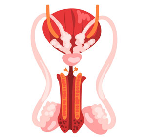 Surgical Sperm Retrieval