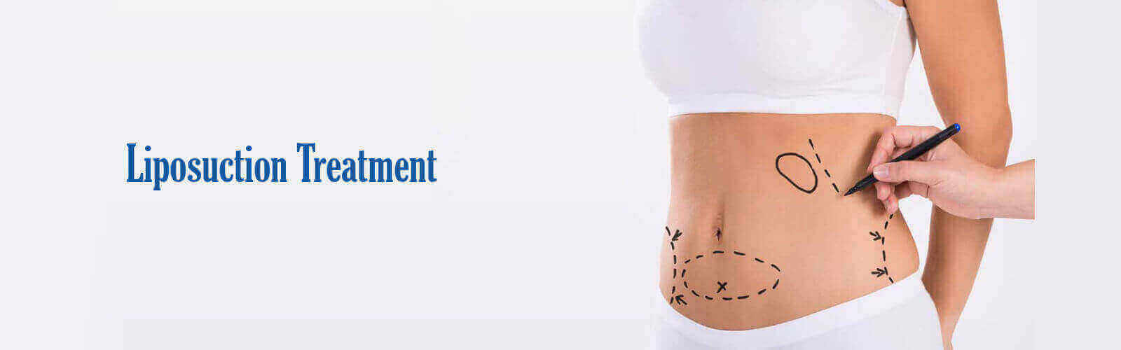Liposuction Treatment in Vijayawada